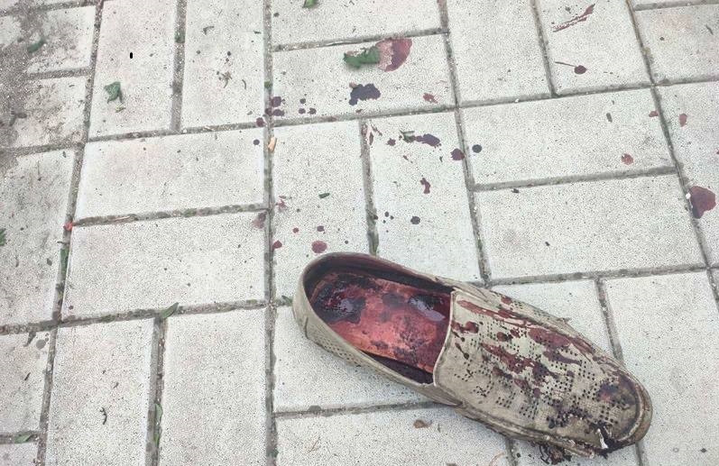 Обстрел Николаева: снаряды упали рядом с остановкой, погибли пять человек (фото, видео 18+) - 2 - изображение